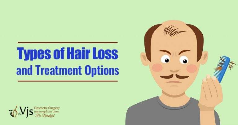 Explain The Types Of Hair Loss And Also State Here Treatment Options