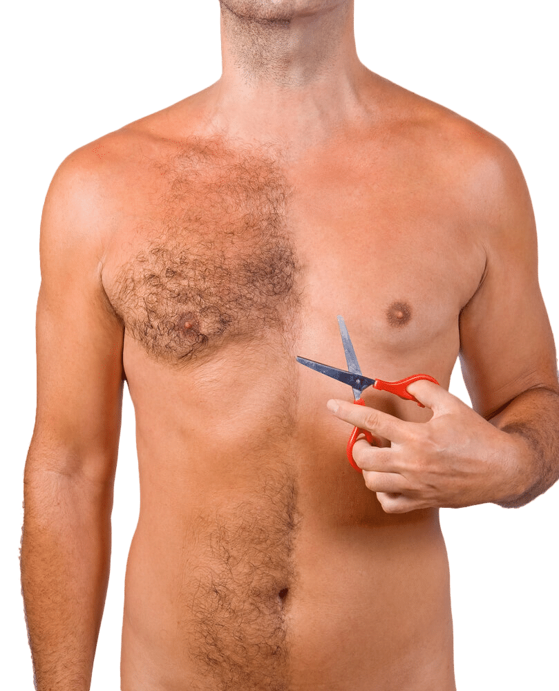 How much do you know about Body Hair Transplant (BHT)?