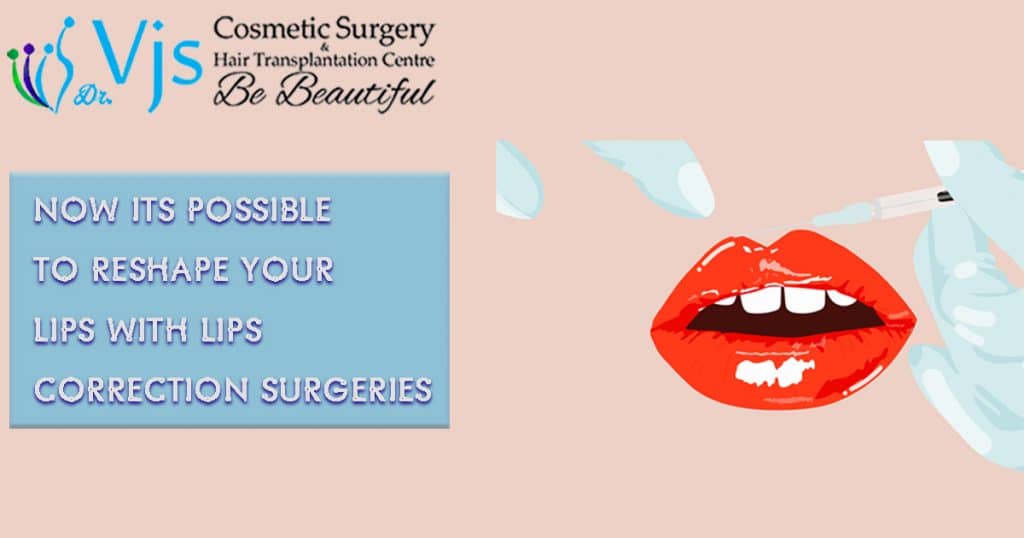 Lips correction surgeries for the larger lips