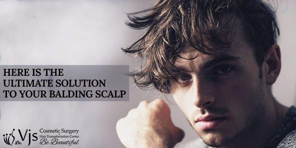 Ultimate Solution to Your Balding Scalp