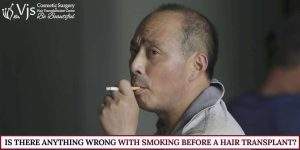 Is there anything wrong with smoking before A Hair Transplant?