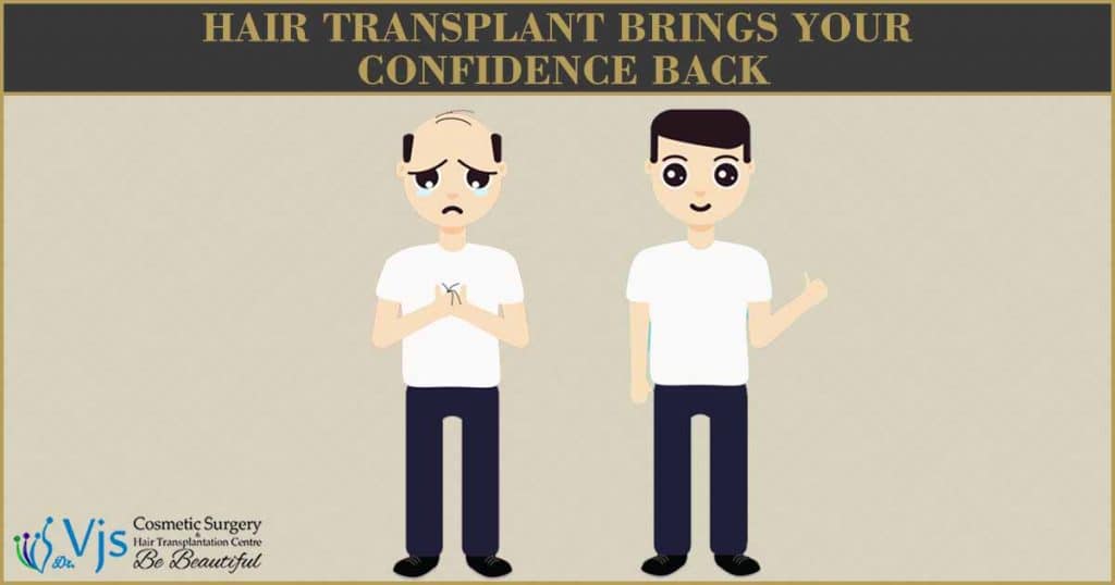 Hair Transplant Brings Your Confidence Back