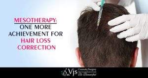 Mesotherapy: One more Achievement for Hair Loss Correction