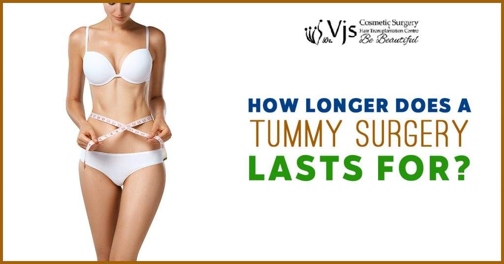 How Long Does A tummy tuck surgery Lasts for?
