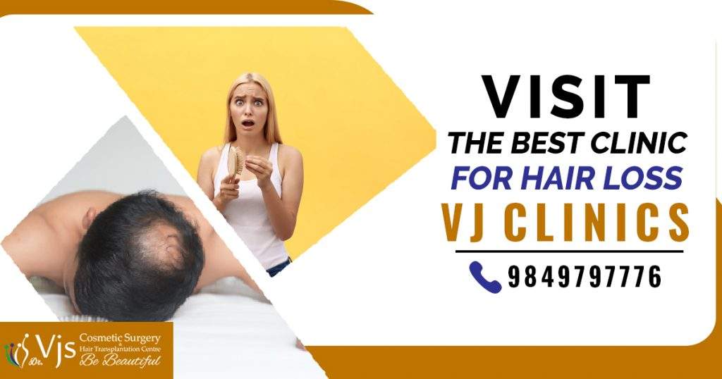 best-clinic-for-Hair-loss
