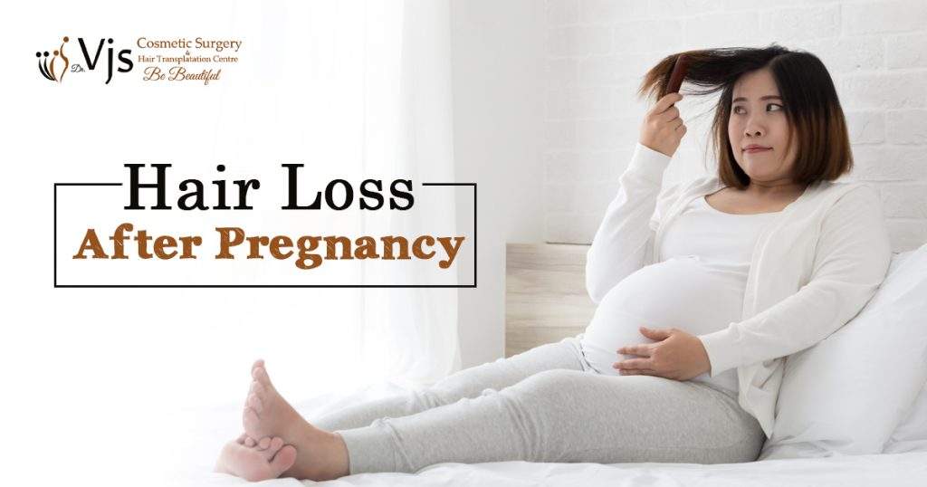 Hair-Loss-After-Pregnancy