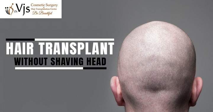 Hair transplant without shaving head
