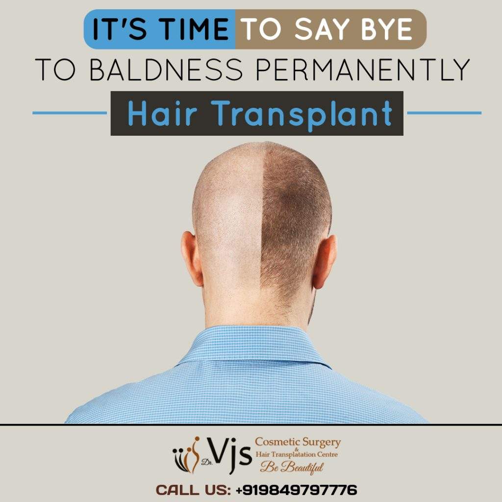 hair transplant treatment over a period of time