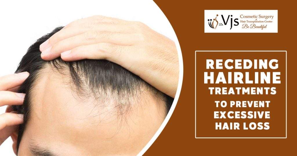 3 Best Hairline Treatments to Prevent Excessive Hair Loss