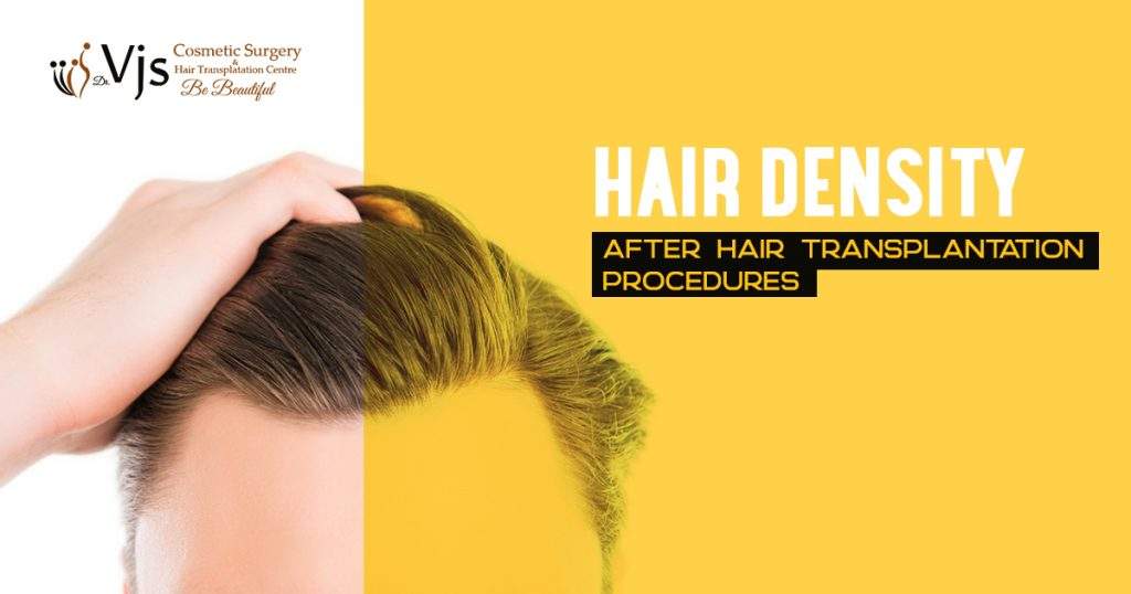 Hair-density-after-hair-transplantation