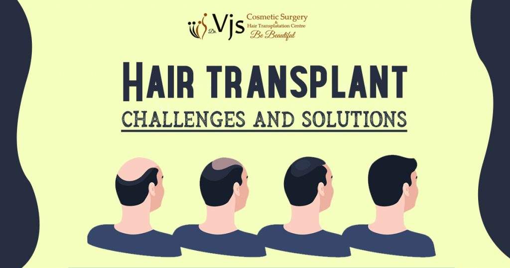 Hair-transplant-Challenges-and-solutions