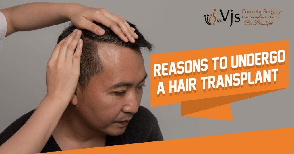 easons to Undergo a Hair Transplant - Dr.Vj's