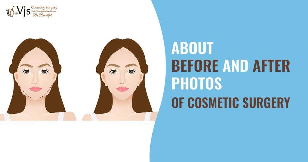 What are the topmost tips to examine before and after photos of cosmetic surgery?