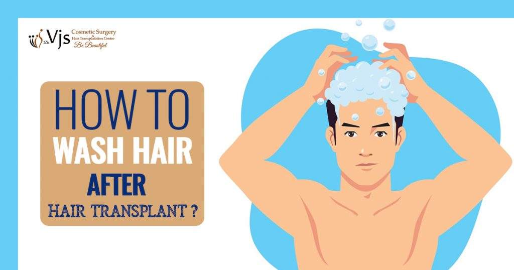 Steps & Guide To Wash Hair After Hair Transplant