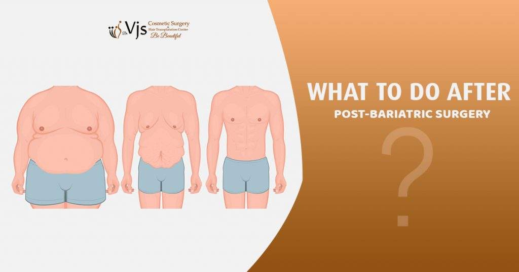 Cosmetic Surgery: Skin is sagging after Bariatric surgery, Here’s what you need to do