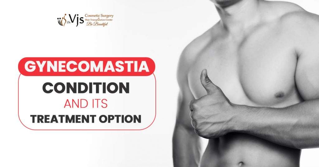 What is the reason for Gynecomastia and what is the way to treat it?