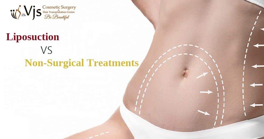 Which to choose between Liposuction and Noninvasive Fat Reduction Procedures?