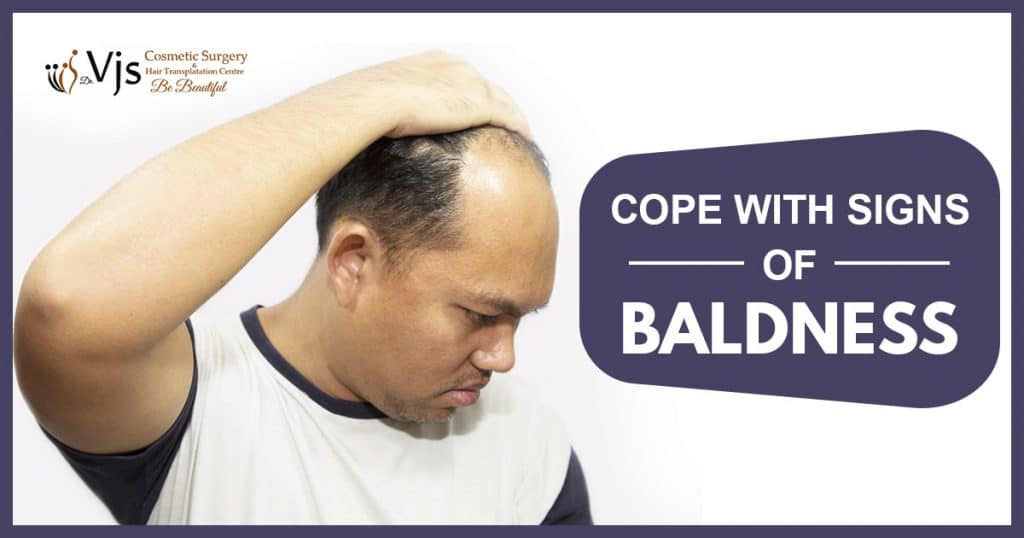 Baldness and want to get rid of them