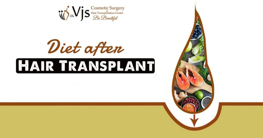 What kind of diet should you follow after the hair transplant treatment?