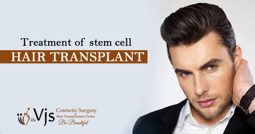 Everything You Need To Know About Stem Cells Hair Transplant Treatment