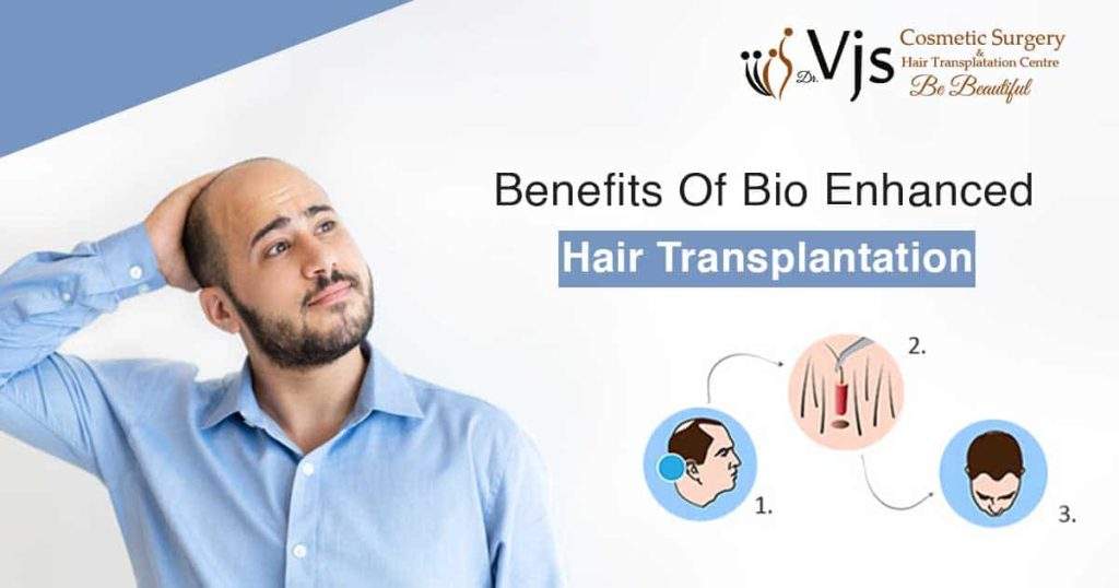 What is a Bio Enhanced Hair Transplantation and explain its benefits?