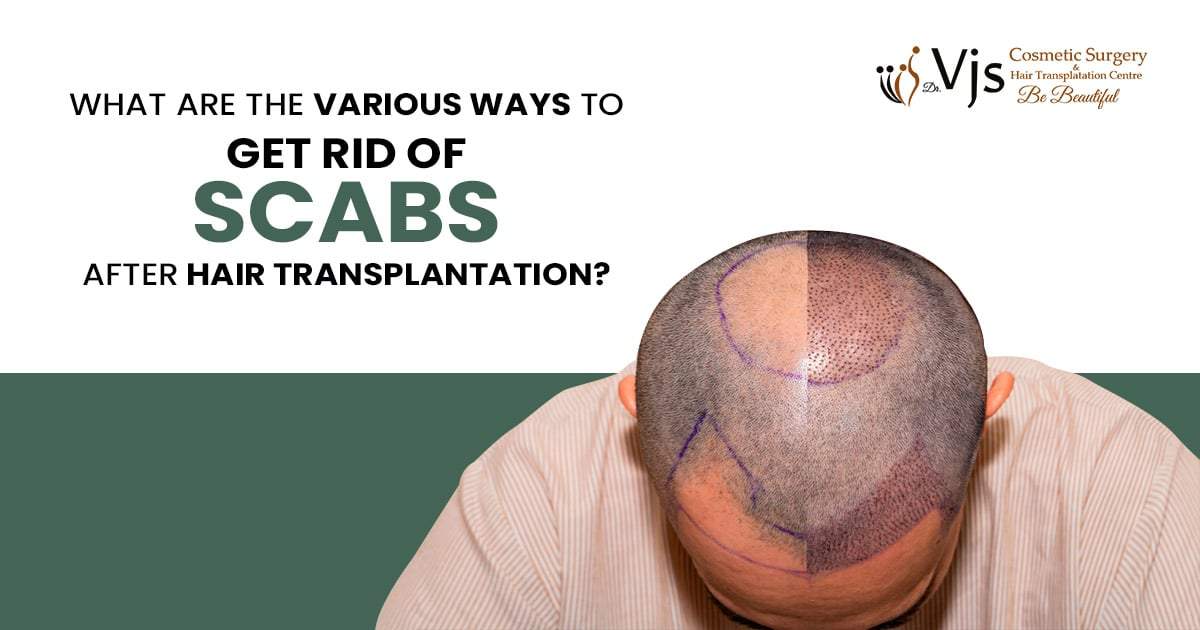 What are the various ways to get rid of scabs after hair transplantation?