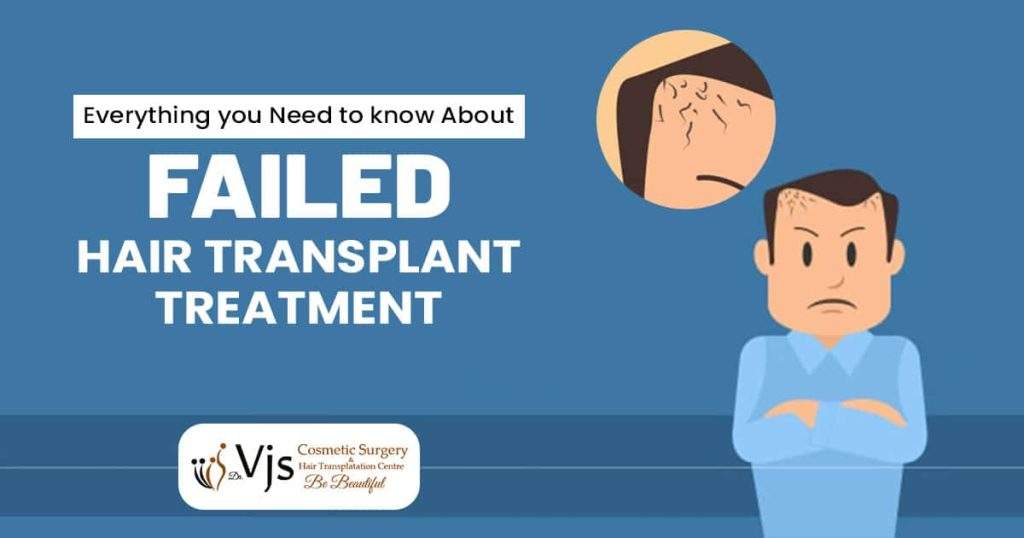 Everything you need to know about Failed Hair Transplant treatment
