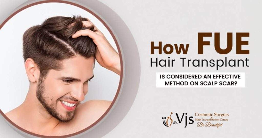 How FUE hair transplant is considered an effective method on scalp scar?