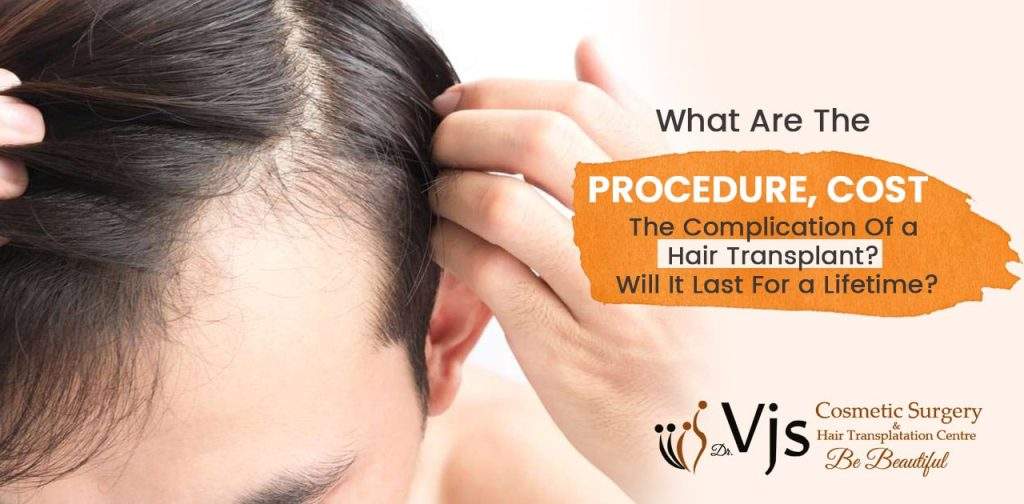 What are the procedure, cost, the complication of a hair transplant? Will it last for a lifetime?