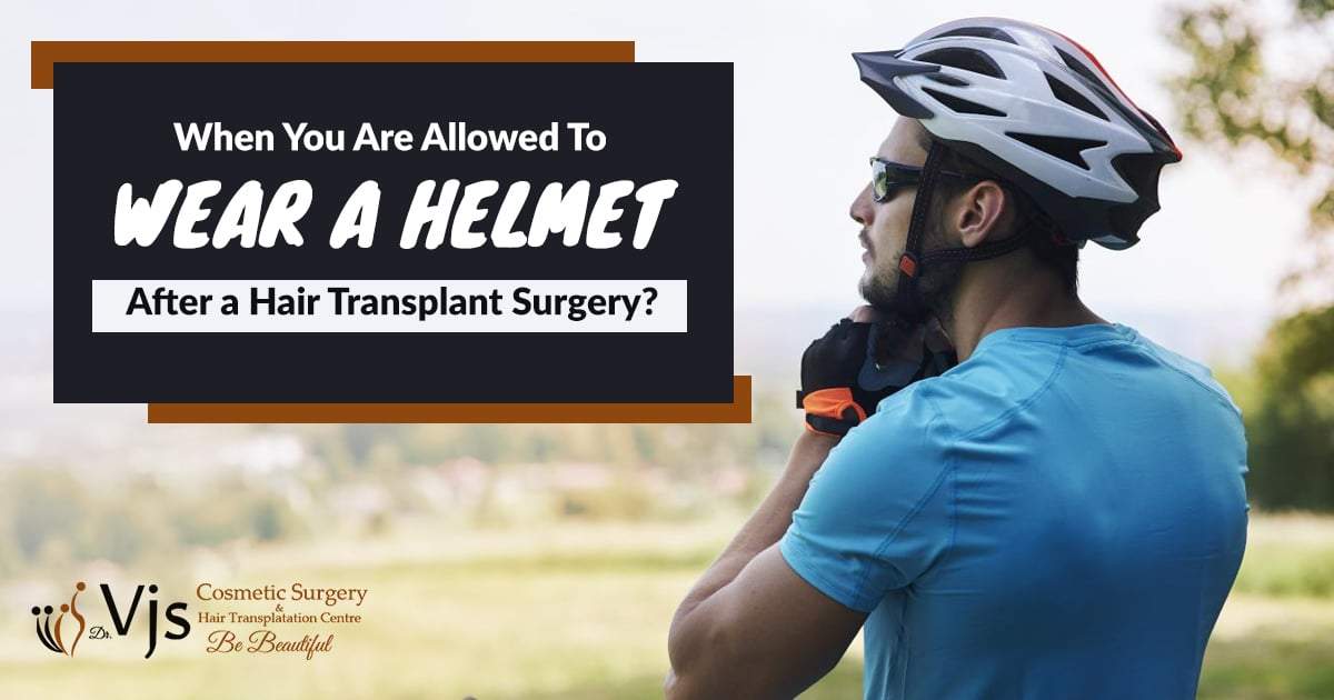 When you are allowed to wear a helmet after a hair transplant surgery?