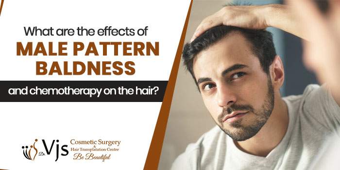 Everything you need to know about FUE hair transplant treatment in India