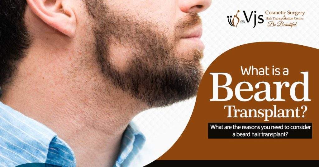 What is a beard transplant? What are the reasons you need to consider a beard hair transplant?