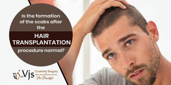Is the formation of the scabs after the hair transplantation procedure normal?
