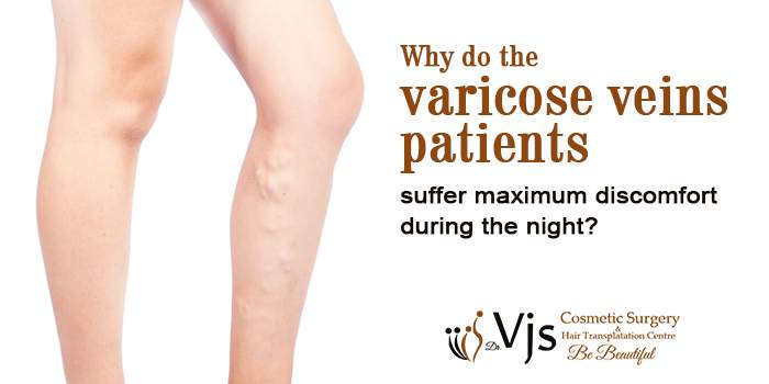 Why do the varicose veins patients suffer maximum discomfort during the night?