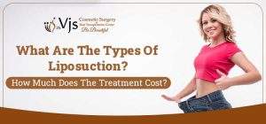 liposuction types