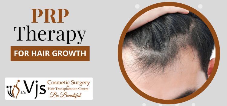 PRP Treatment – Non Surgical Solution for Hair Restoration
