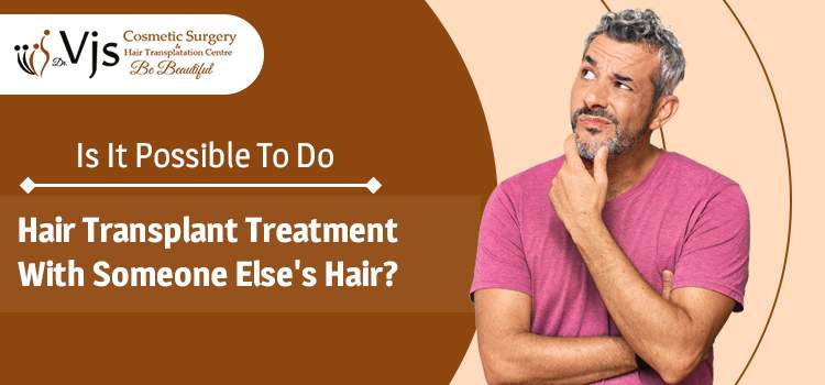 Is-it-possible-to-do-hair-transplant-treatment-with-someone-elses-hair-vjc-jpg