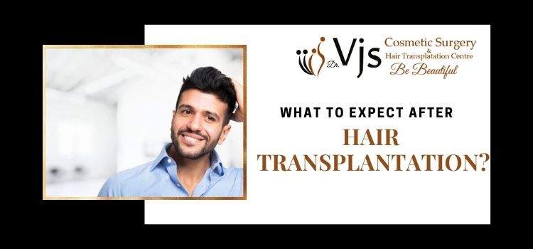 How many grafts are needed to get the treatment of hair transplant?