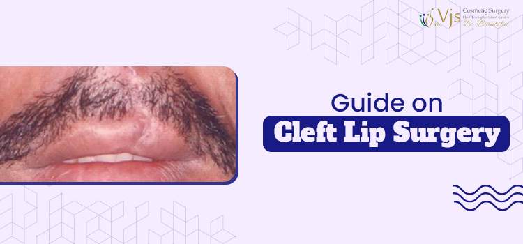 Everything you need to know about the cleft platelet lip surgery