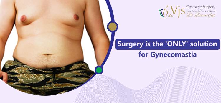 Surgery is the 'ONLY' solution for Gynecomastia