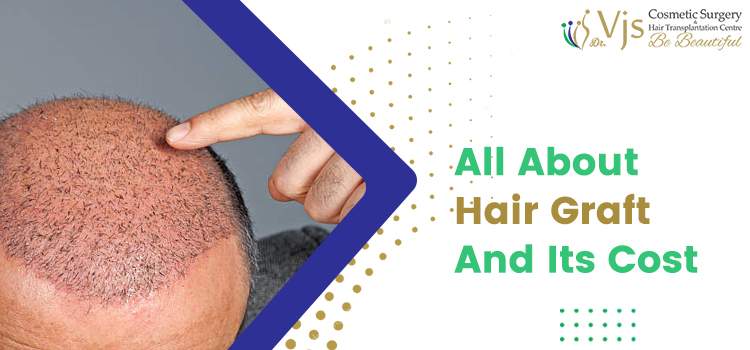 All About Hair Graft And Its Cost