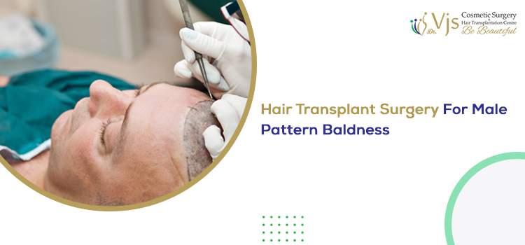 Hair Transplant Surgery For Male Pattern Baldness