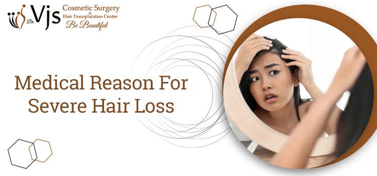 Medical Reason For Severe Hair Loss