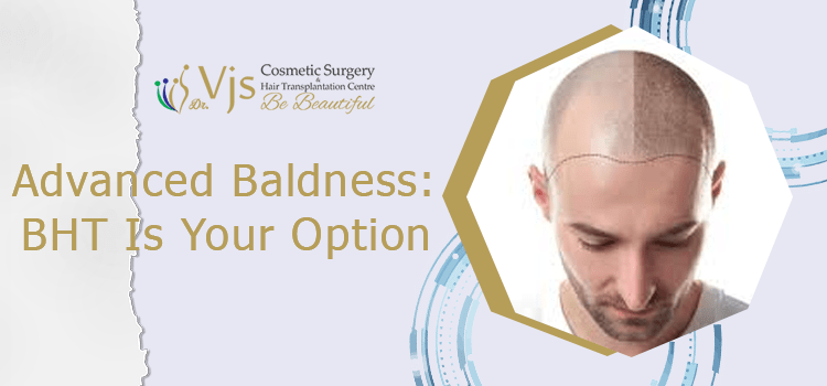 Advanced-Baldness-BHT-Is-Your-Option