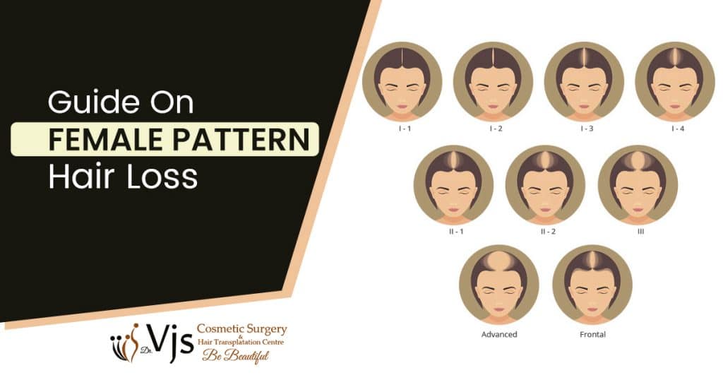 Does Female Pattern Hair Loss Result In Thinning Hair And Hair Loss?