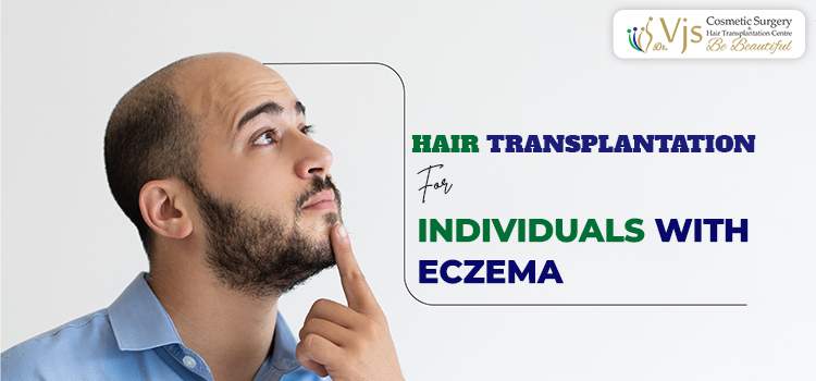 Hair Transplantation for Individuals with Eczema