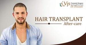 Hair transplant after care