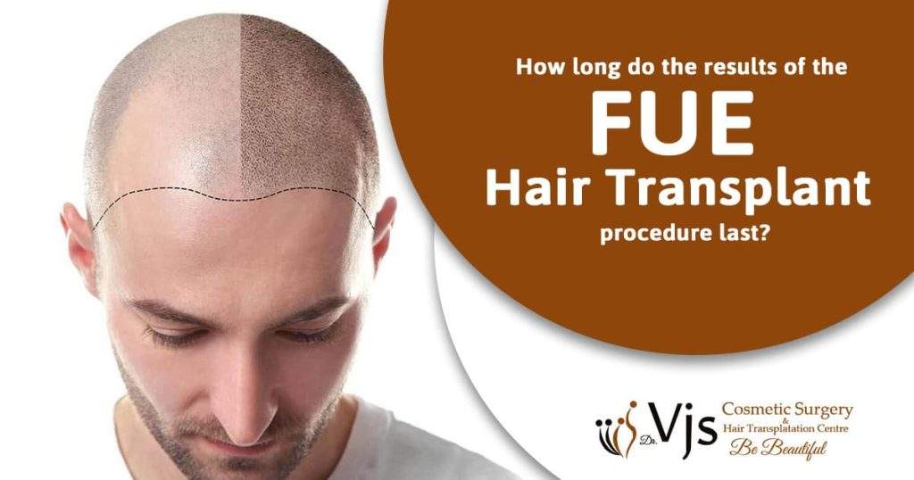 How long do the results of the FUE hair transplant procedure last