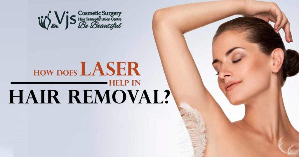 how does laser help in hair removal?