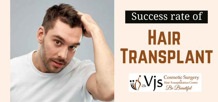 Success rate of hair transplant